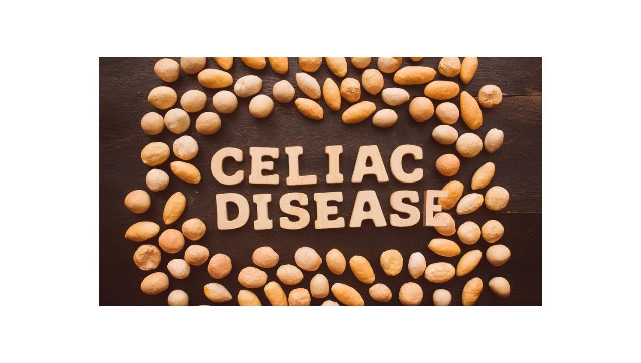 Celiac Disease: Symptoms, Diagnosis & Treatment Options